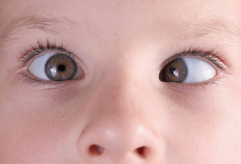 Paediatric eye examination