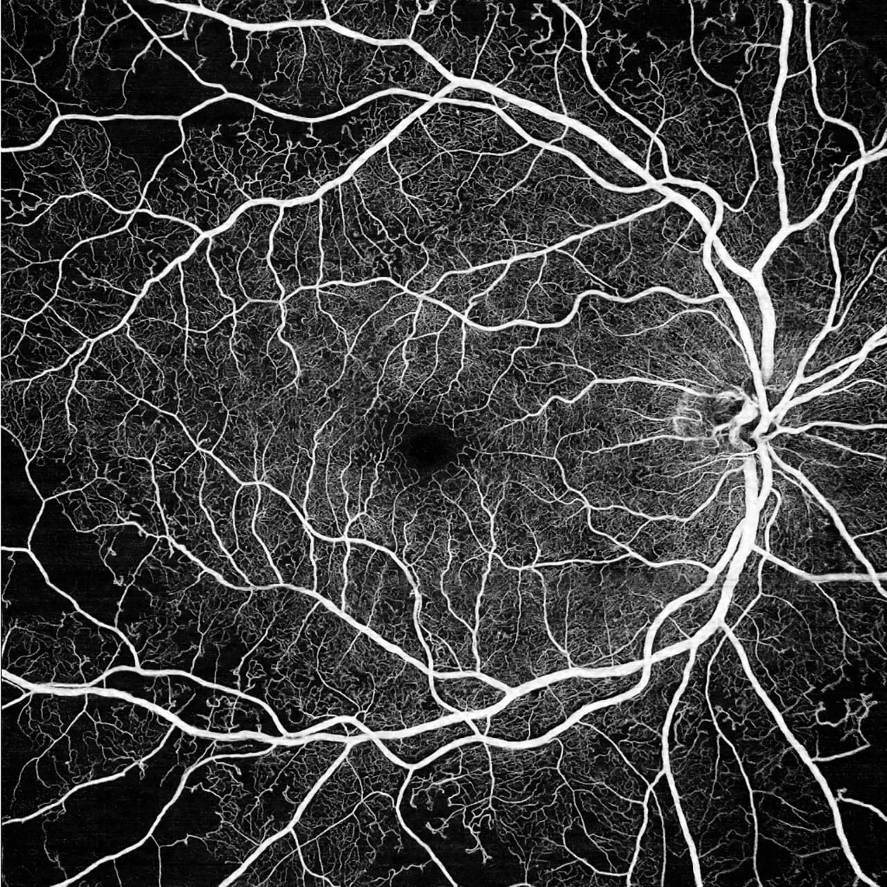 Retinal imaging